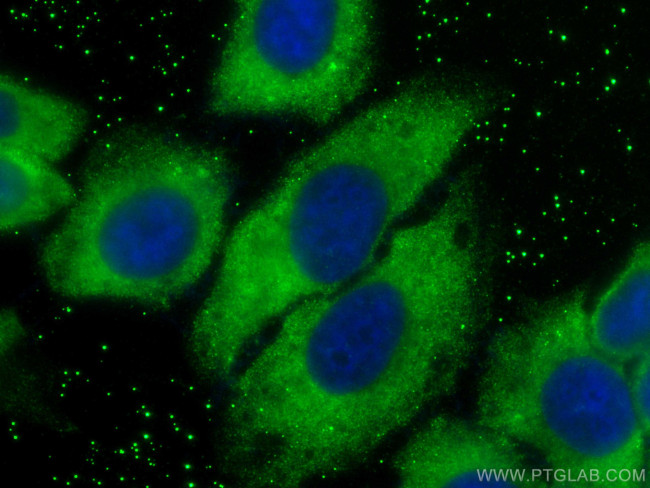 CD5L Antibody in Immunocytochemistry (ICC/IF)