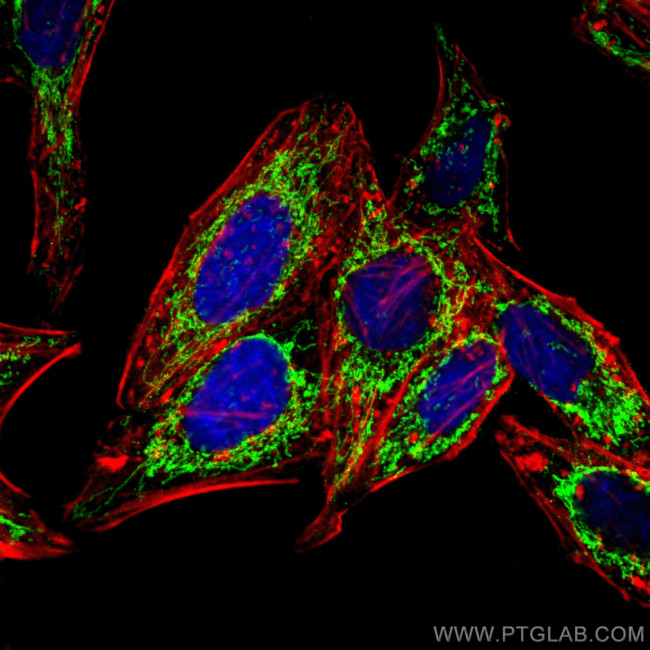 ATPB Antibody in Immunocytochemistry (ICC/IF)