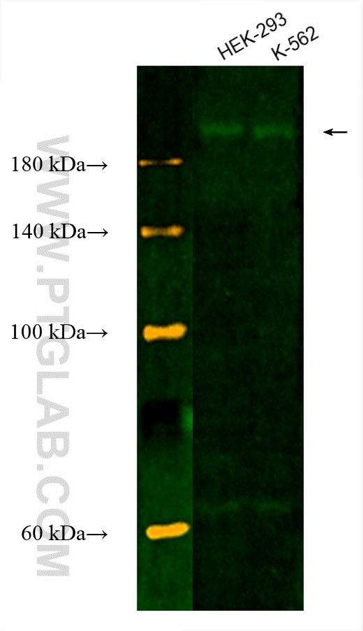 RB1CC1 Antibody in Western Blot (WB)