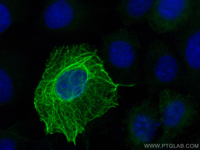 Cytokeratin 16 Antibody in Immunocytochemistry (ICC/IF)