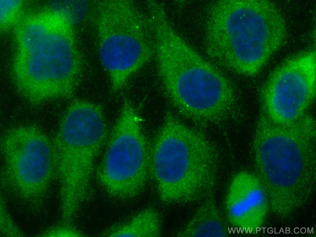 CALML3 Antibody in Immunocytochemistry (ICC/IF)
