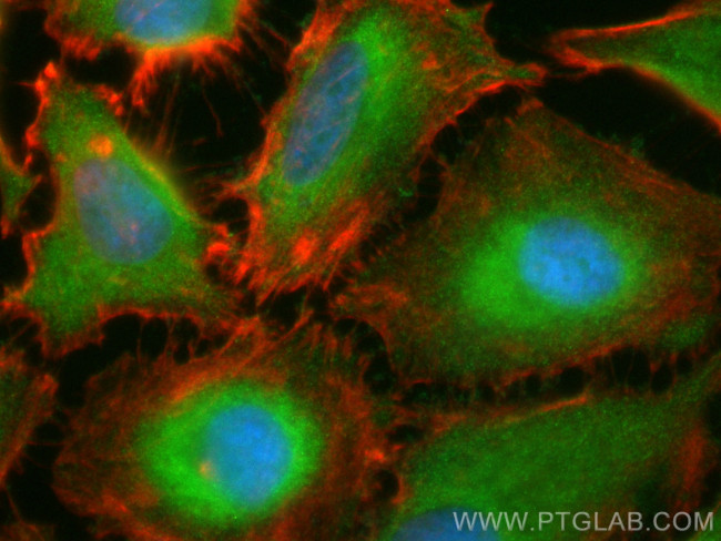 EXD1 Antibody in Immunocytochemistry (ICC/IF)