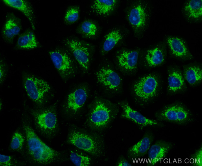 PADI4 Antibody in Immunocytochemistry (ICC/IF)
