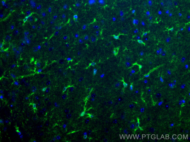 ALDH1L1 Antibody in Immunohistochemistry (PFA fixed) (IHC (PFA))