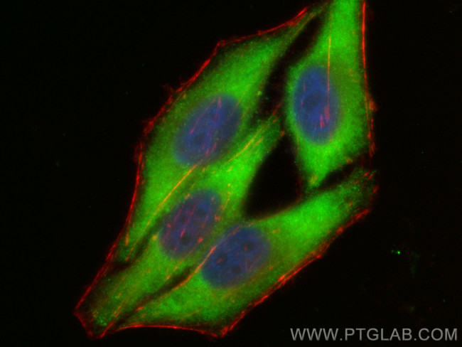 AlaRS Antibody in Immunocytochemistry (ICC/IF)