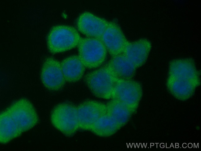 RIP3 Antibody in Immunocytochemistry (ICC/IF)