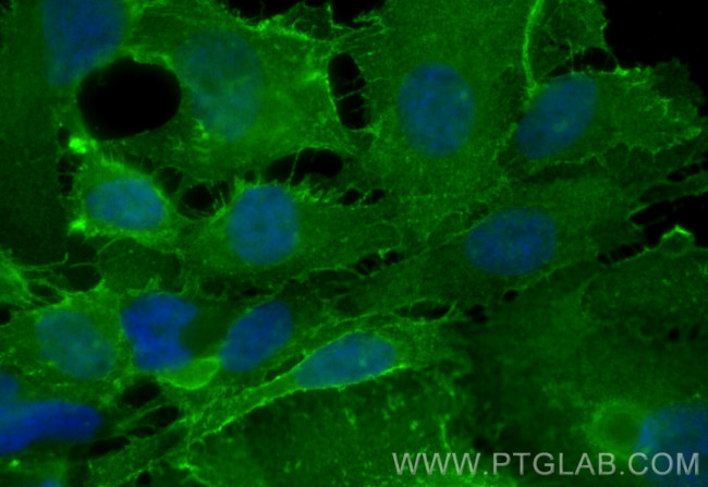 CD146/MCAM Antibody in Immunocytochemistry (ICC/IF)