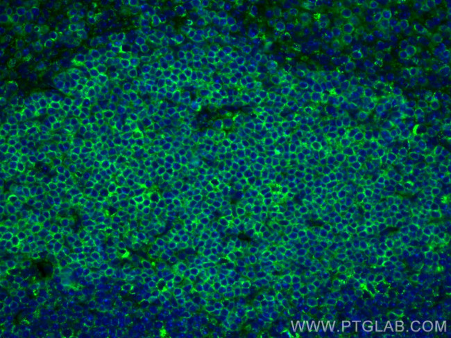 CD3 Antibody in Immunohistochemistry (PFA fixed) (IHC (PFA))