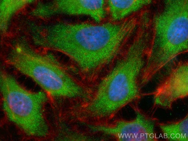 RPL26 Antibody in Immunocytochemistry (ICC/IF)