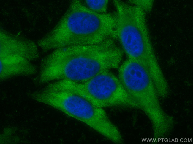 PRMT3 Antibody in Immunocytochemistry (ICC/IF)