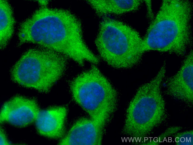 CSK Antibody in Immunocytochemistry (ICC/IF)