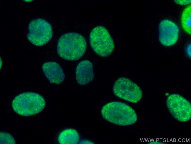 DHX9 Antibody in Immunocytochemistry (ICC/IF)