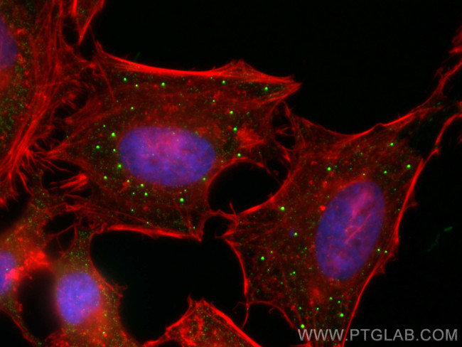 EDC4 Antibody in Immunocytochemistry (ICC/IF)