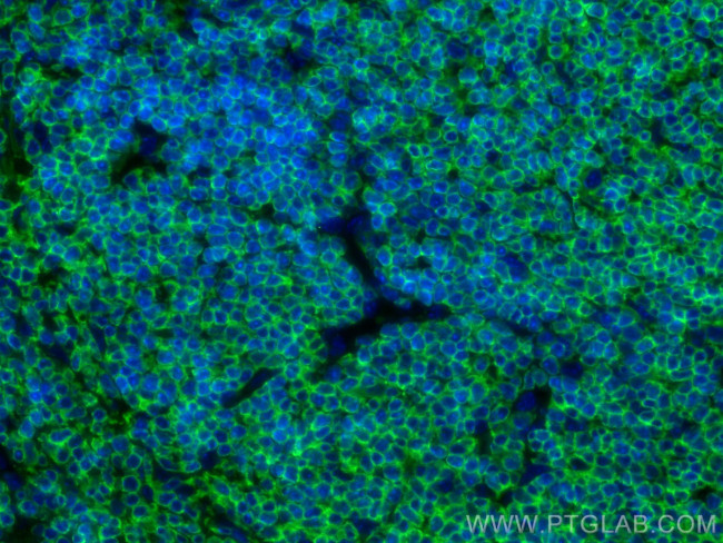 CORO1A Antibody in Immunohistochemistry (PFA fixed) (IHC (PFA))