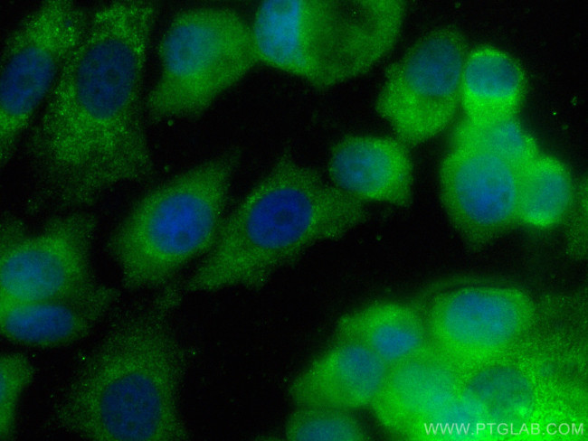 SPERT Antibody in Immunocytochemistry (ICC/IF)