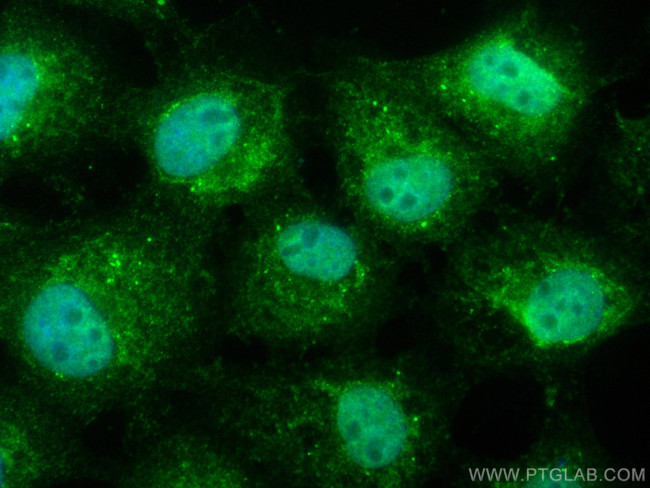 TP53INP1 Antibody in Immunocytochemistry (ICC/IF)