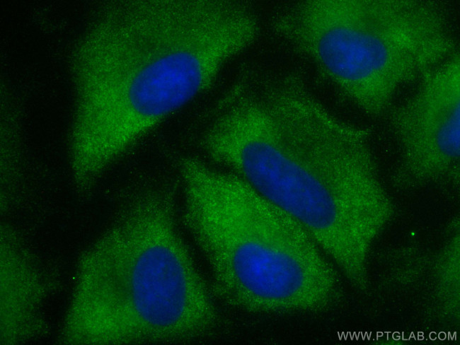 MMP3 Antibody in Immunocytochemistry (ICC/IF)