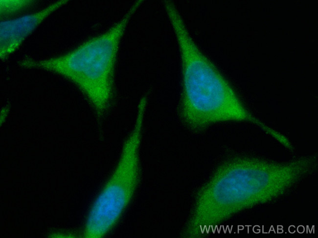 VPS15 Antibody in Immunocytochemistry (ICC/IF)