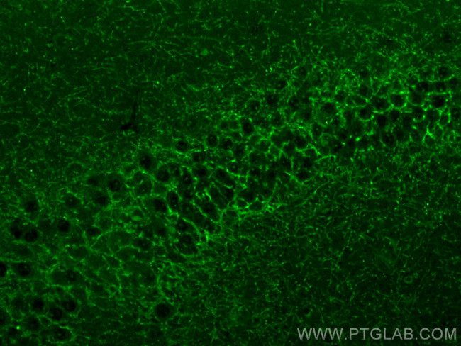 Cannabinoid receptor 1 Antibody in Immunohistochemistry (PFA fixed) (IHC (PFA))