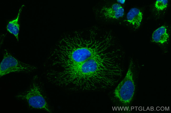 AIF Antibody in Immunocytochemistry (ICC/IF)