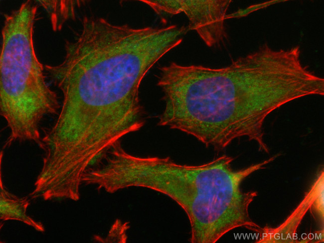 EIF2B1 Antibody in Immunocytochemistry (ICC/IF)