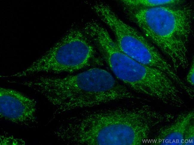 PDH E1 Alpha Antibody in Immunocytochemistry (ICC/IF)
