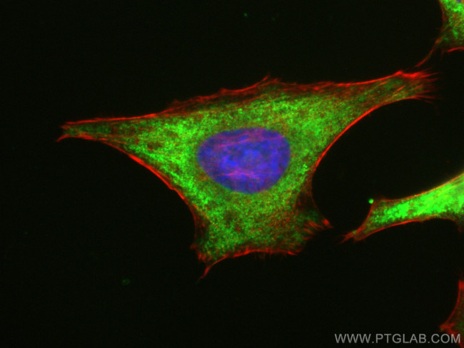 FARSA Antibody in Immunocytochemistry (ICC/IF)