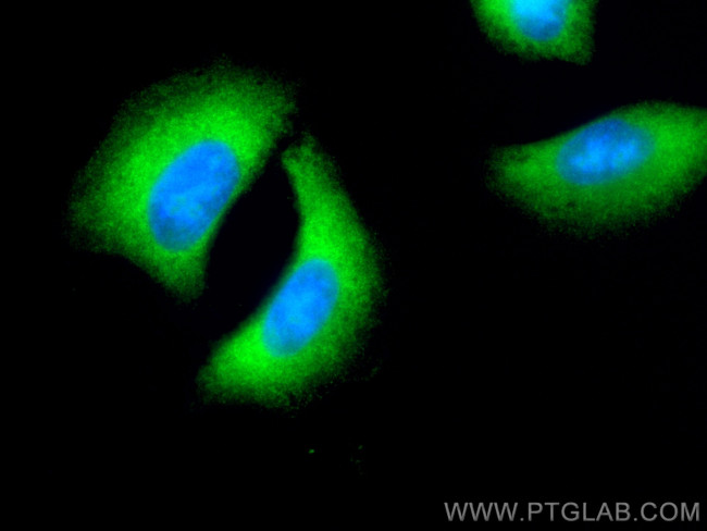 CPLX2 Antibody in Immunocytochemistry (ICC/IF)