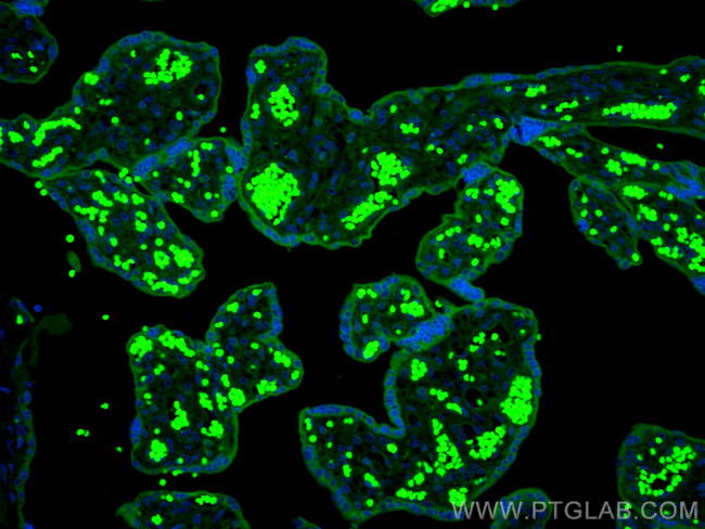 TRPC6 Antibody in Immunohistochemistry (PFA fixed) (IHC (PFA))