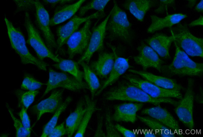EIF2AK2, PKR Antibody in Immunocytochemistry (ICC/IF)