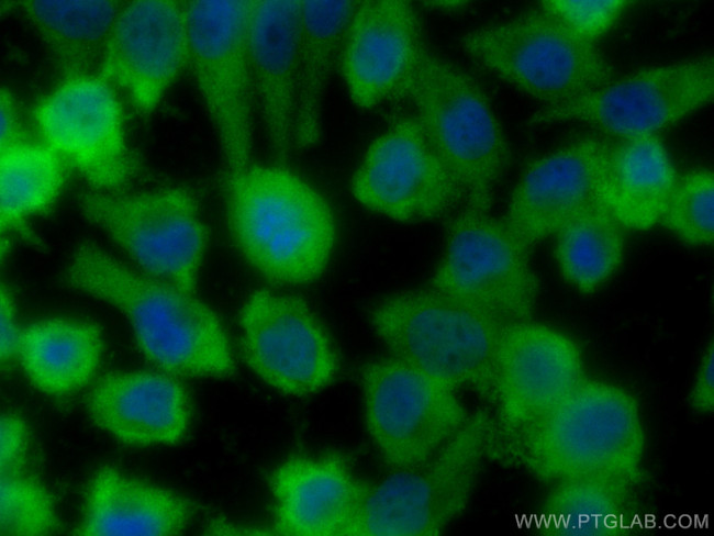 PHLDA1 Antibody in Immunocytochemistry (ICC/IF)