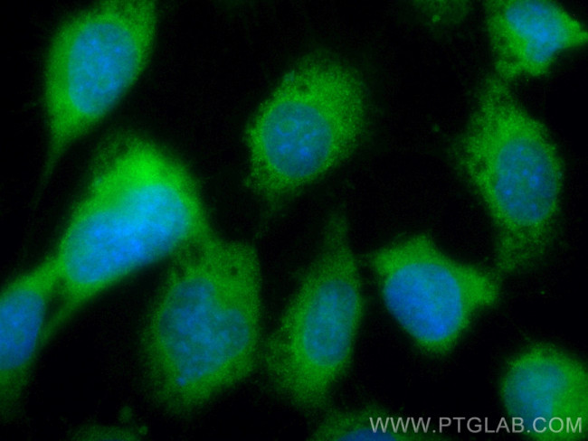 SSH3 Antibody in Immunocytochemistry (ICC/IF)