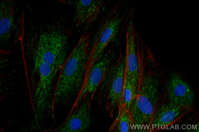 TRIM41 Antibody in Immunocytochemistry (ICC/IF)