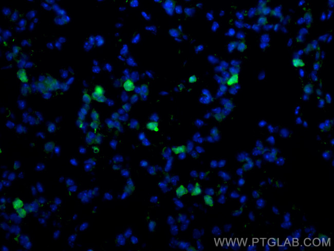 CD206 Antibody in Immunohistochemistry (PFA fixed) (IHC (PFA))