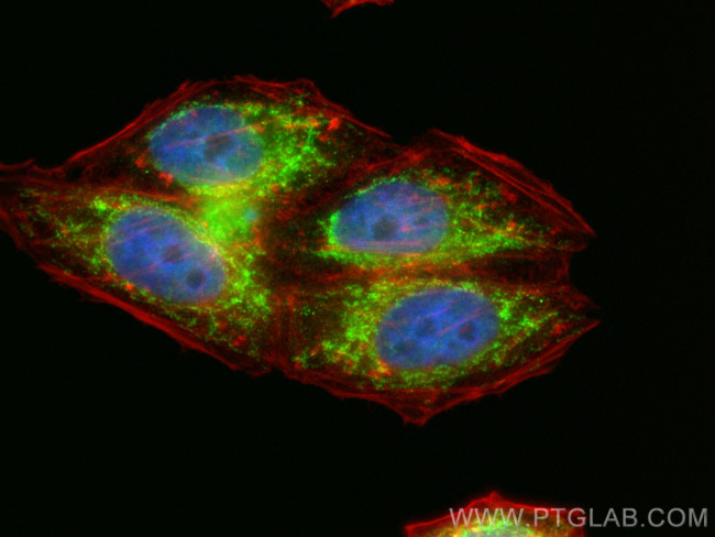 MRPS17 Antibody in Immunocytochemistry (ICC/IF)