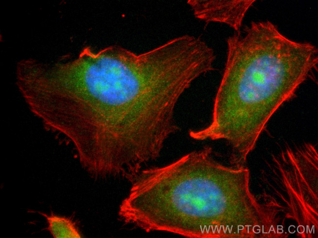 BAG1 Antibody in Immunocytochemistry (ICC/IF)