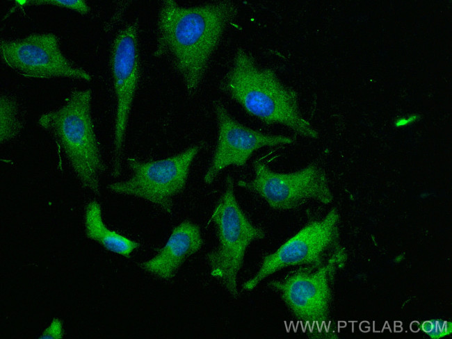 RAP1GAP Antibody in Immunocytochemistry (ICC/IF)