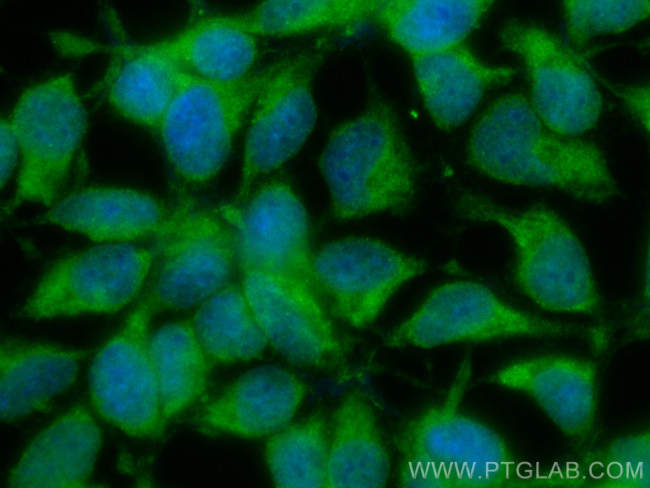 ZIP7 Antibody in Immunocytochemistry (ICC/IF)