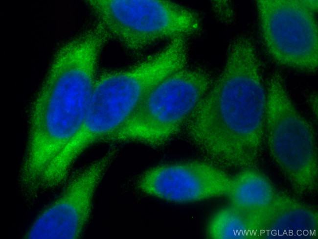 NLRP3 Antibody in Immunocytochemistry (ICC/IF)