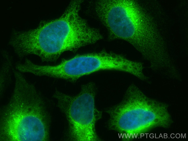TXNDC5 Antibody in Immunocytochemistry (ICC/IF)