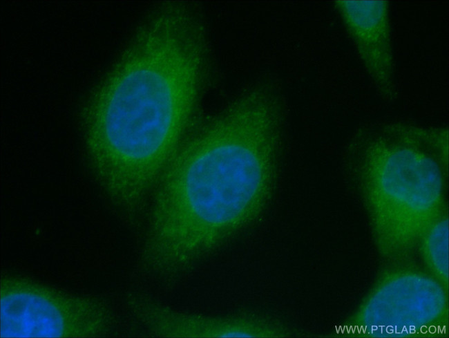 TMEM173 Antibody in Immunocytochemistry (ICC/IF)