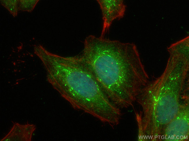 APPL1 Antibody in Immunocytochemistry (ICC/IF)