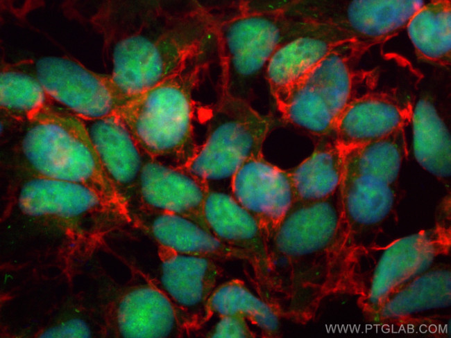 DDX17 Antibody in Immunocytochemistry (ICC/IF)