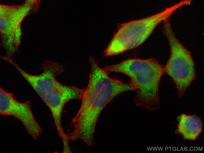 BZW1 Antibody in Immunocytochemistry (ICC/IF)
