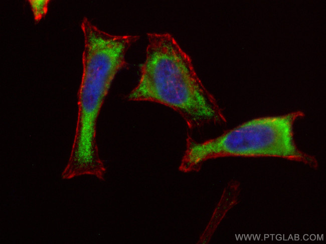 CUEDC2 Antibody in Immunocytochemistry (ICC/IF)