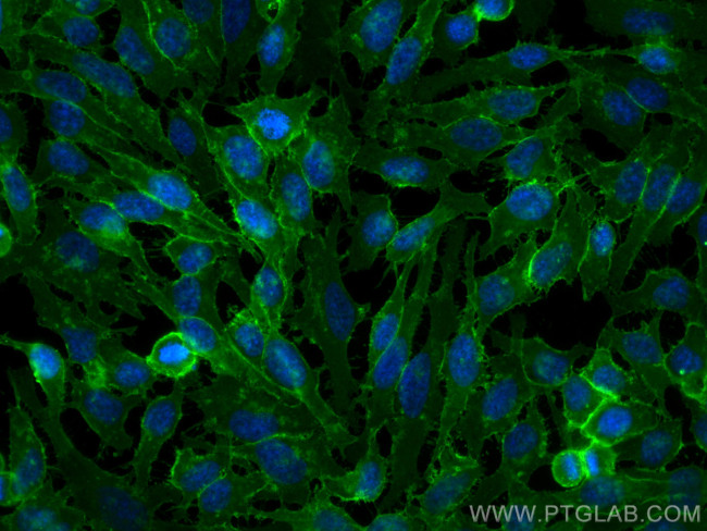 MCT1 Antibody in Immunocytochemistry (ICC/IF)