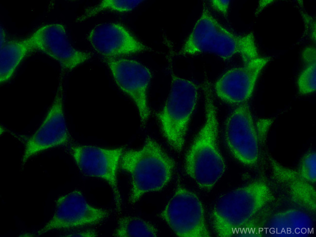 KGA Antibody in Immunocytochemistry (ICC/IF)
