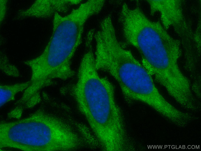 CLEC3B Antibody in Immunocytochemistry (ICC/IF)