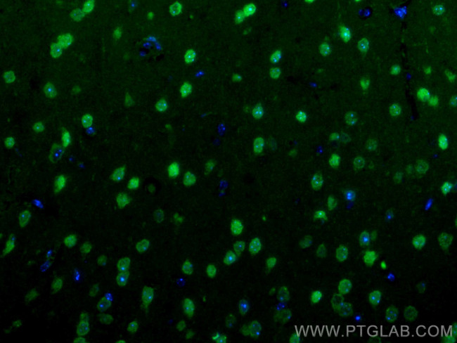 MEF2C Antibody in Immunohistochemistry (PFA fixed) (IHC (PFA))