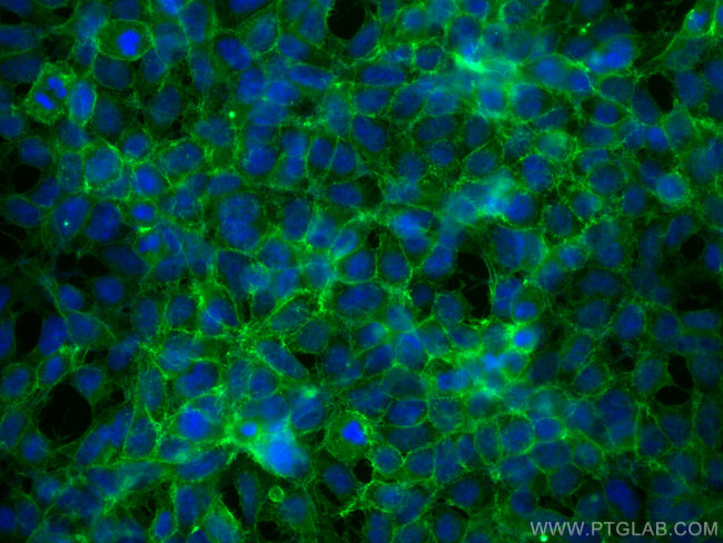 ASCT2 Antibody in Immunocytochemistry (ICC/IF)